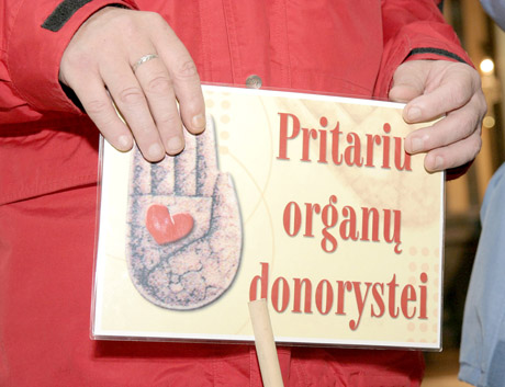 Užgesusi moteris organus paaukojo kitiems Užgesusi moteris organus paaukojo kitiems